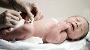 come trattare una ferita ombelicale