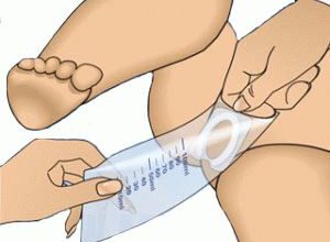 com els nadons recopilen l’orina per analitzar-los