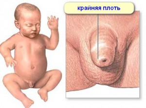 higiene íntima de meninos recém-nascidos