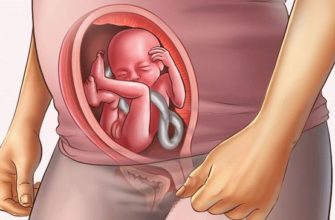 20 semanas de gravidez
