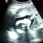 Foto de Uzi com 21 semanas