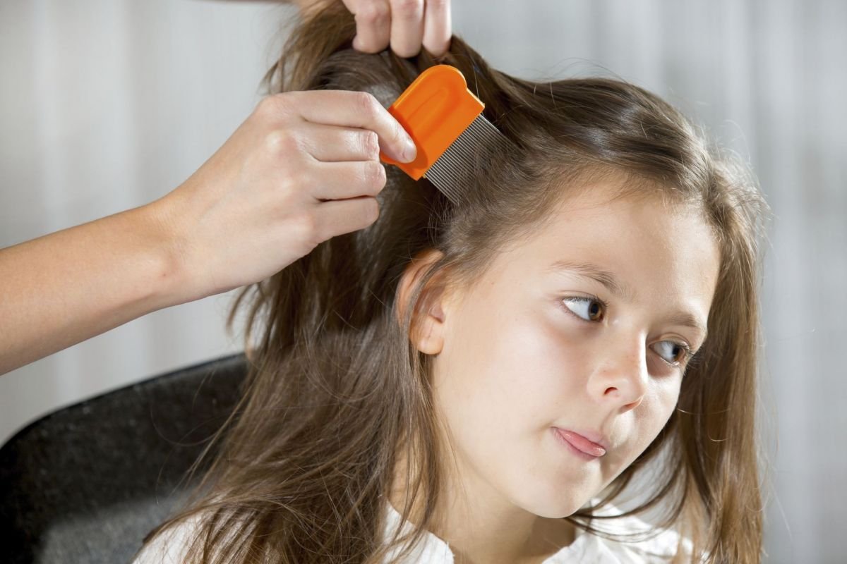 en un niño PEDICULOSIS